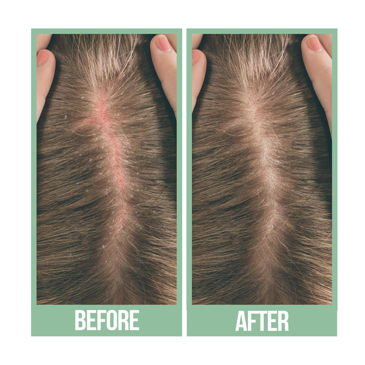 Difeel Scalp Care Premium Natural Hair Oil Tea Tree Oil 8 oz